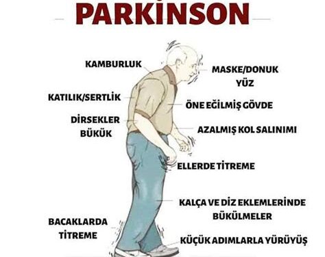 Titrek Sırlar: Parkinson Testi ve Hareketlerin Gizemli Dansı